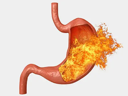 Understanding the Causes of Acidity and How Shashavi Ayurveda Can Help - Shashvi Ayurveda